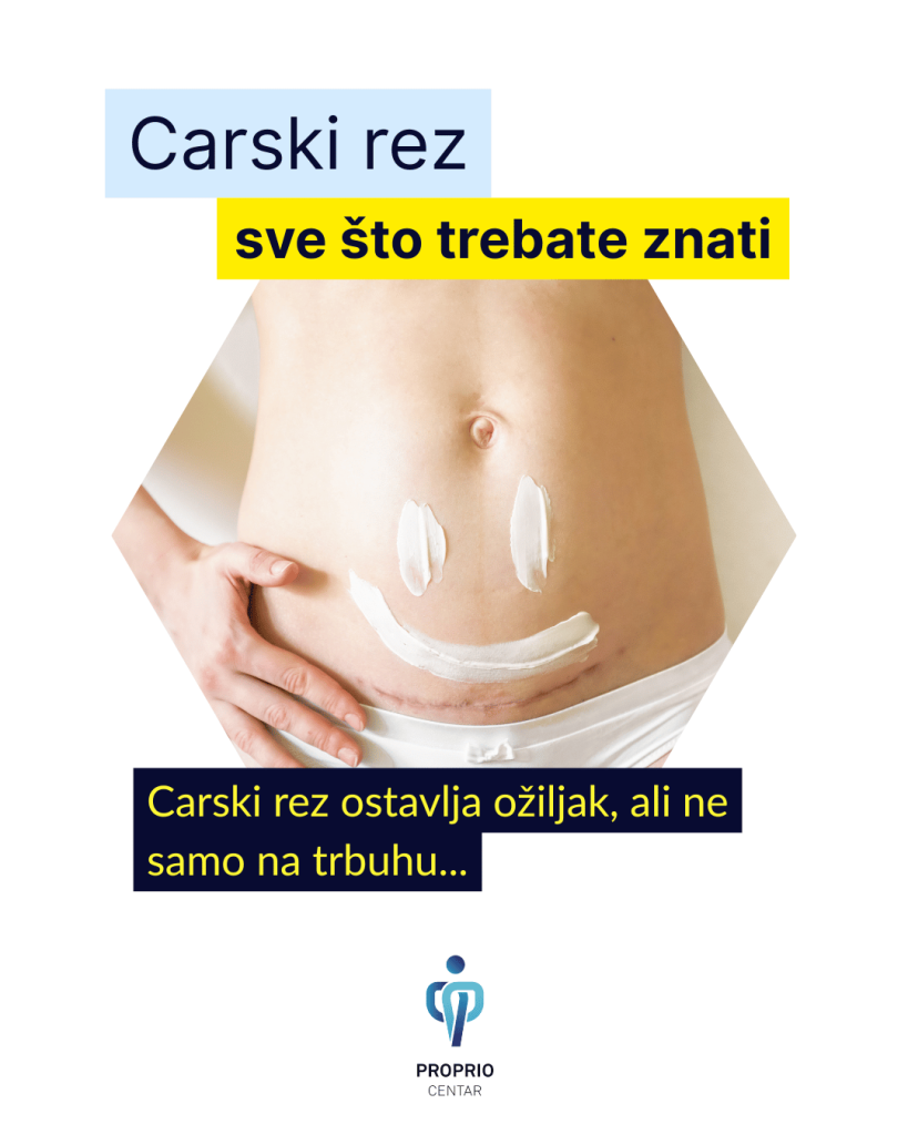 Objava IG